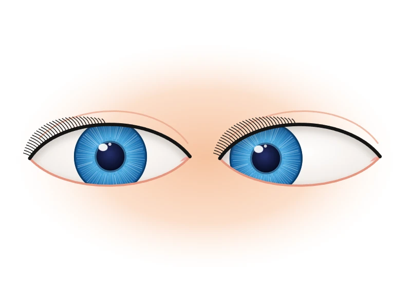 Squint